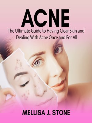 cover image of Acne